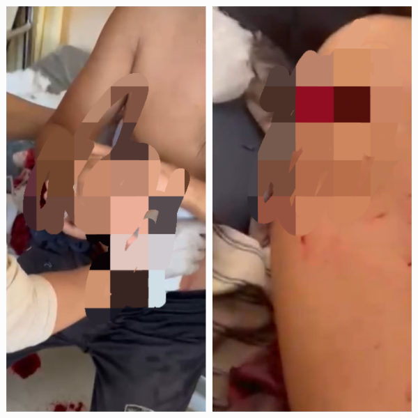 Fhoto : 2 Korban Luka Bacok