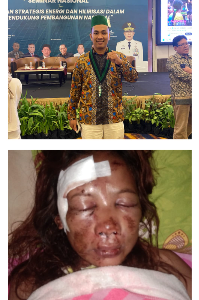 https://gardatipikornews.com/gma-sultra-ungkap-fakta-pekerjaan-ruas-jalan-tawarombadaka-solewatu-yang-diduga-gagal-konstruksi